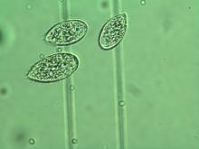 Tetrahymena pyriformis fénymikroszkópos képe (nagyítás: 600-szoros)